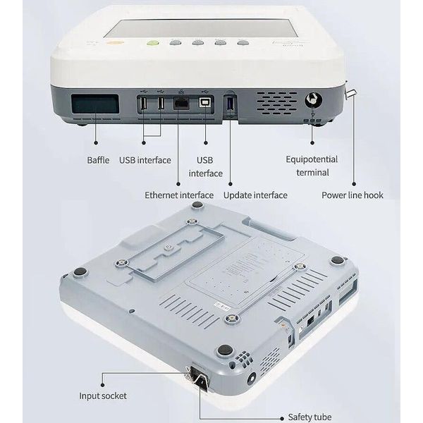 SPIROMETRO CONTEC SP100B CON STAMPANTE - schermo touch 10,1" - con accessori e software