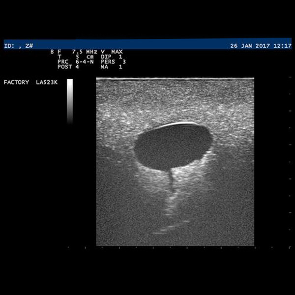 SIMULATORE DI MAMMELLA CON CISTI PER ULTRASUONI SONOtrain™