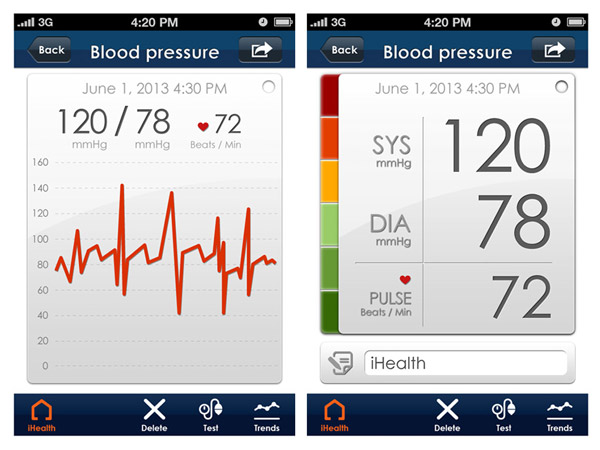 MISURATORE PRESSIONE iHEALTH BP7 POLSO WIRELESS BLUETOOTH 