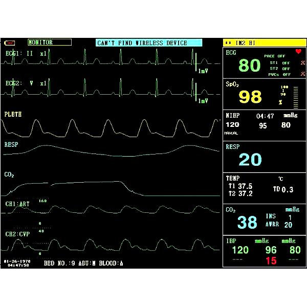 MONITOR MULTIPARAMETRICO PAZIENTE CONTEC NEW CMS 8000 - display 12,1” con ECG, RESP, SpO2, PR, NIBP, doppio canale TEMP