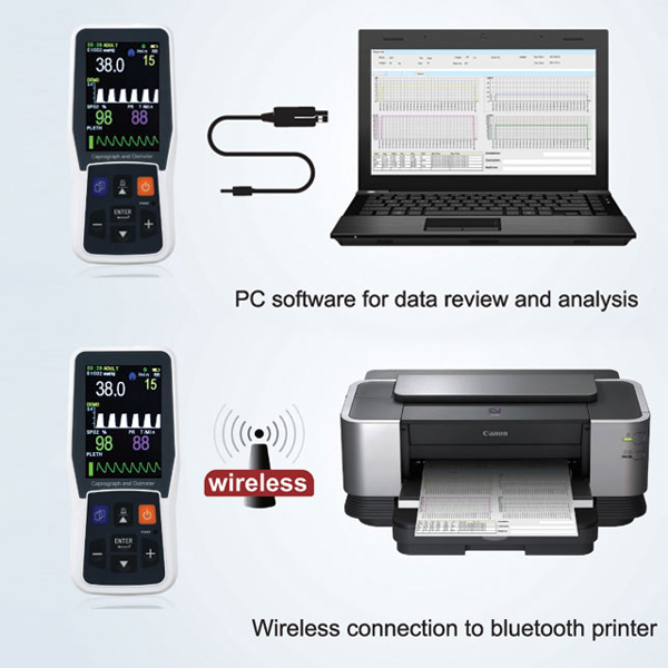 PULSOSSIMETRO SATURIMETRO CAPNOGRAFO OSSIMETRO PC-900B - portatile