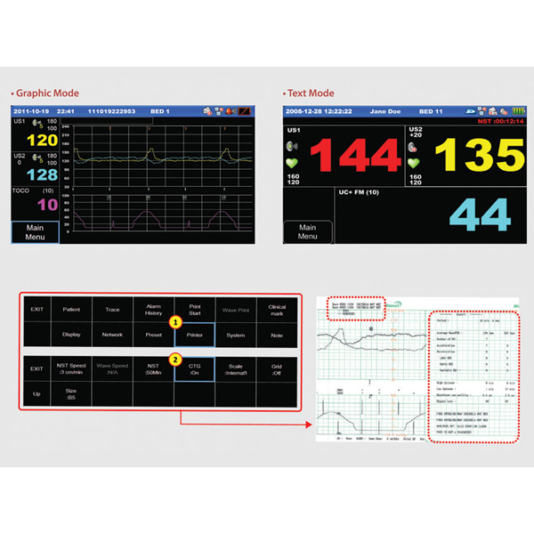 CARDIOTOCOGRAFO MONITOR FETALE FC1400 - singolo - display 7" Touch Screen