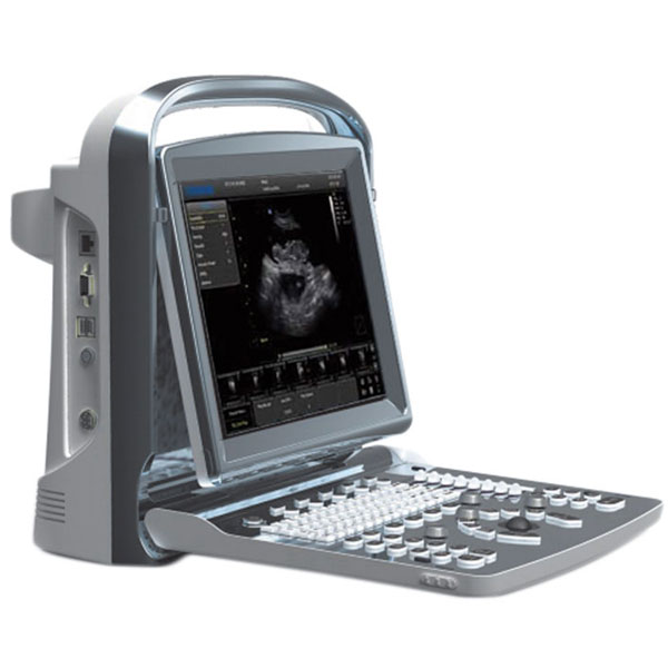 ECOGRAFO PORTATILE CHISON ECO1 BIANCO/NERO per VETERINARIA con 1