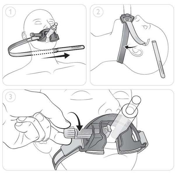 SISTEMA DI BLOCCAGGIO TUBI ENDOTRACHEALI - THOMAS HOLDER - adulto o pediatrico