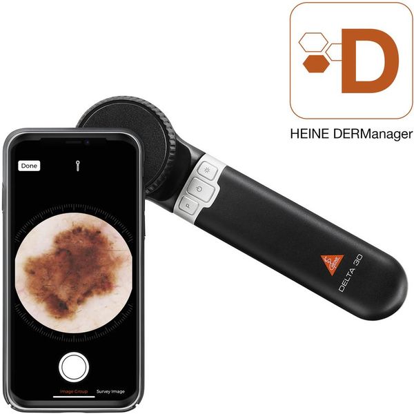 DERMATOSCOPIO HEINE DELTA 30 - K-230.28.305 - ingrandimento 10X - tascabile